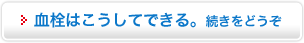 血栓はこうしてできる。続きをどうぞ