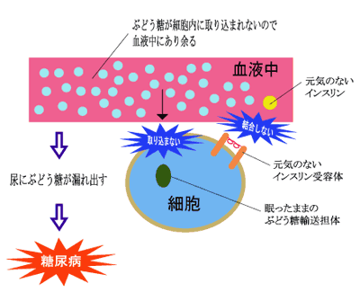 糖尿病発症の仕組み2