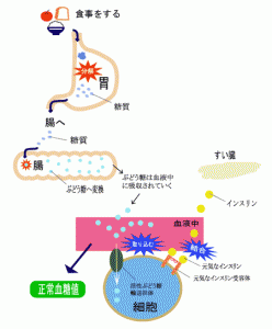 血栓ができる仕組み