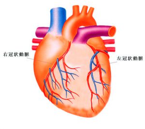 心筋梗塞
